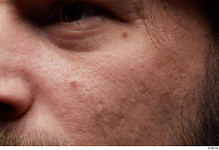  HD Face Skin Arron Cooper cheek face skin pores skin texture wrinkles 0003.jpg